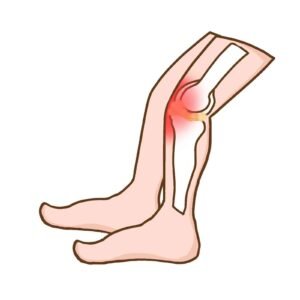 Inflammation