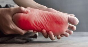 Nerve Pain In Feet Home Remedies