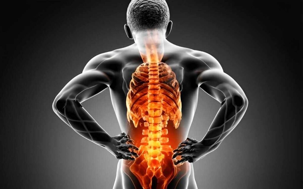 Sciatica Pain Home Remedies to Relieve Sciatica Pain Naturally