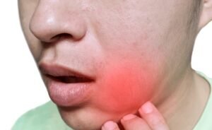 swollen gums