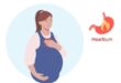 acid reflux during pregnancy (2)