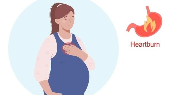 acid reflux during pregnancy (2)