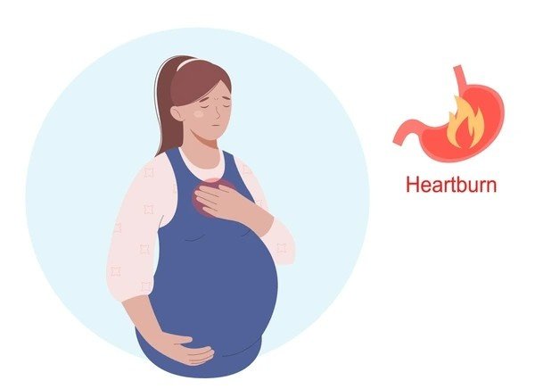 acid reflux during pregnancy (2)
