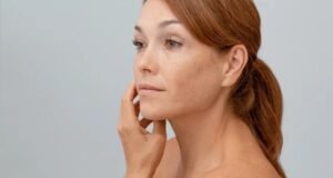 age spots