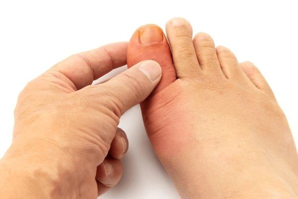 ankle pain and swelling