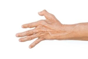 atrophy
