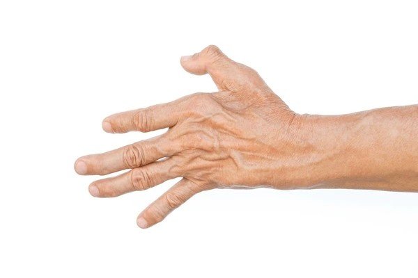 atrophy