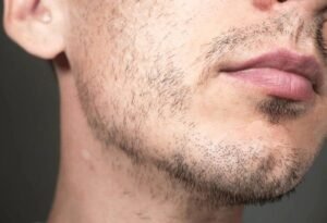 beard growth