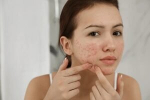 blemishes