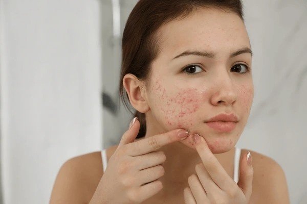 blemishes