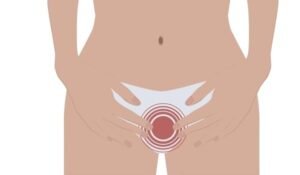 boils on private area female