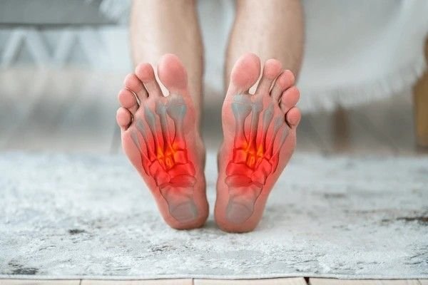 bunions