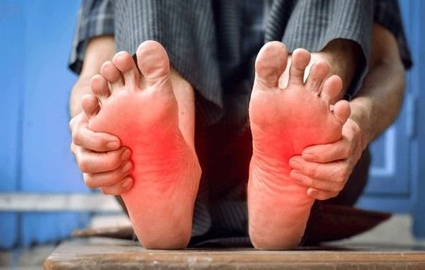 burning feet