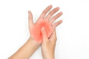 burning sensation in hands