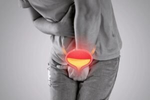 burning urine