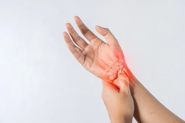 carpal tunnel