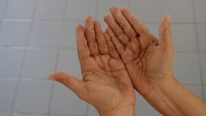 chemo rash