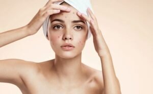 chicken pox spots removal