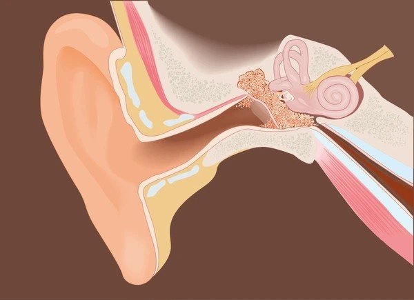 clogged ears