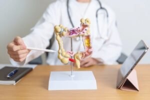 colitis