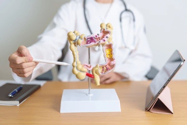 colitis