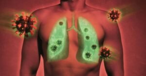 covid lungs
