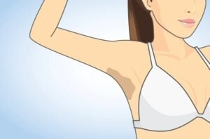 dark underarms