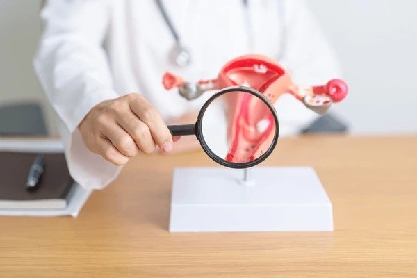 endometriosis