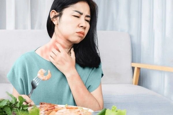 food allergy
