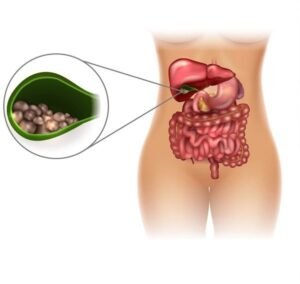 gall bladder stones