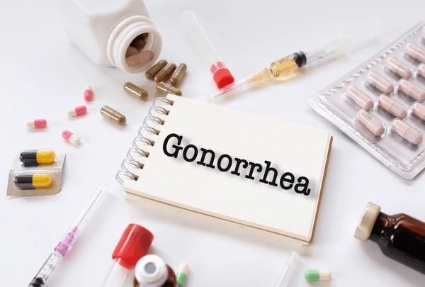 gonorrhea
