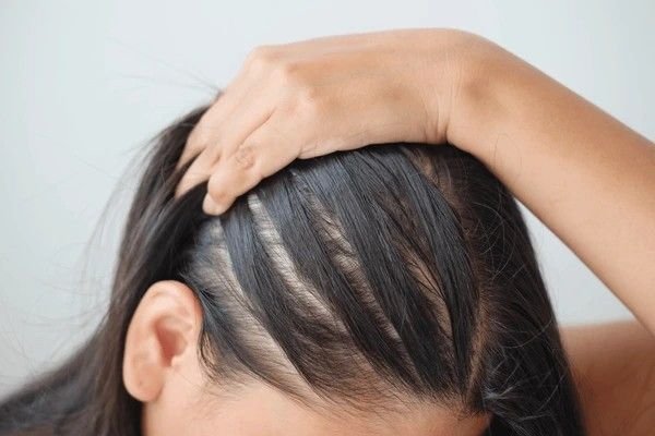 grey hair turns into black