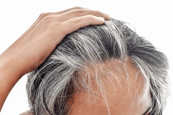 grey hair