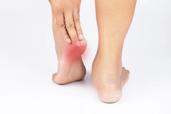 heel spurs