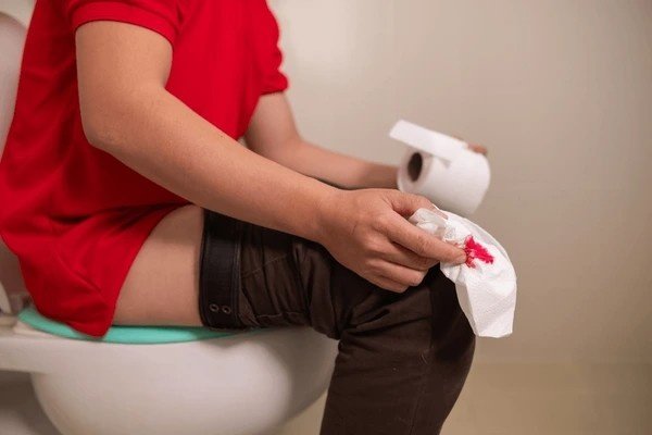 hemorrhoids in anus