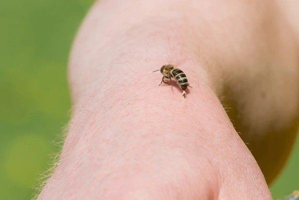honey bee bite