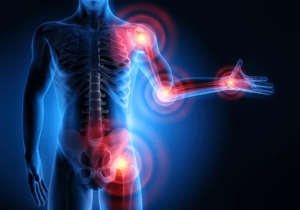 inflammation and pain