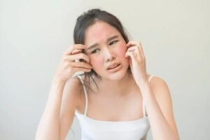 itching on face