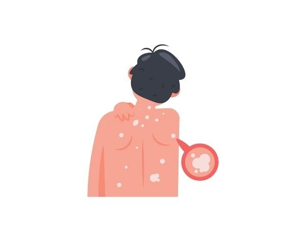 itchy skin all over (2)
