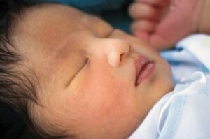 jaundice in newborn