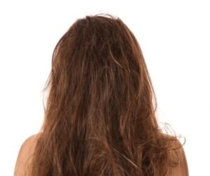 matted hair
