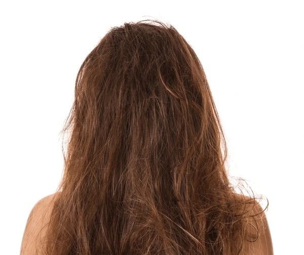 matted hair