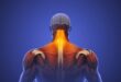 muscle pain and inflammation