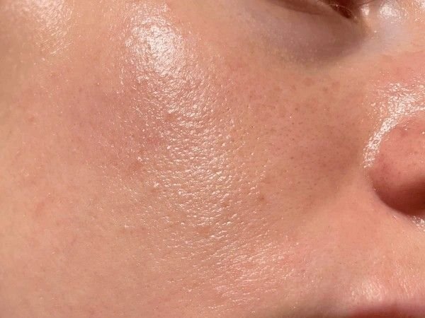 open pores treatment at home for oily skin