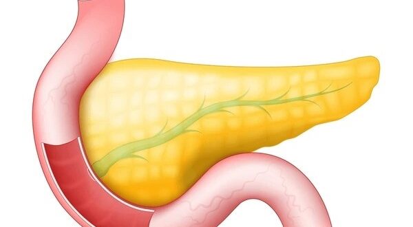 pancreatitis