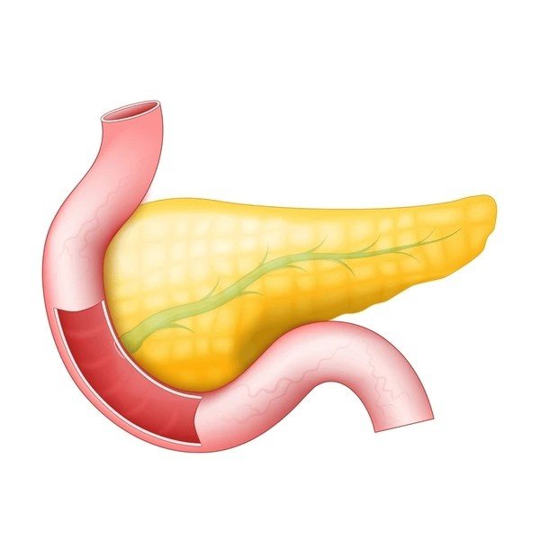 pancreatitis