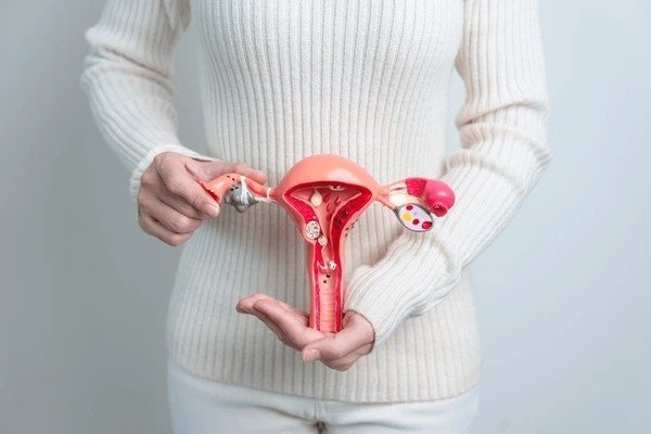 pcos
