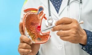 peptic ulcer