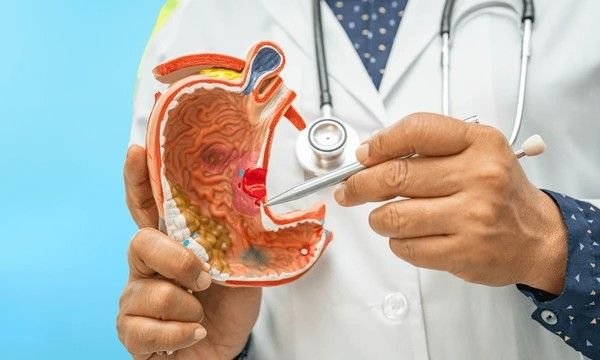 peptic ulcer