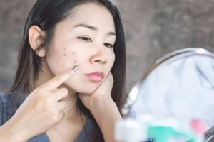 potato juice for dark spots
